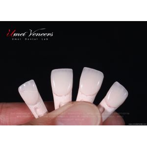 Buy cheap Ultra thin cast porcelain veneer from wholesalers