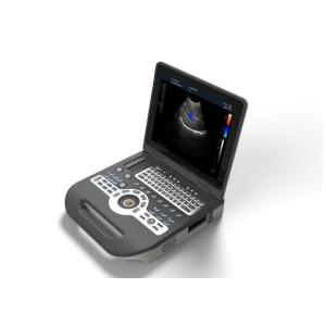 Portable Ultrasound Device Portable Ultrasound Scanner Color Doppler with 2 USB