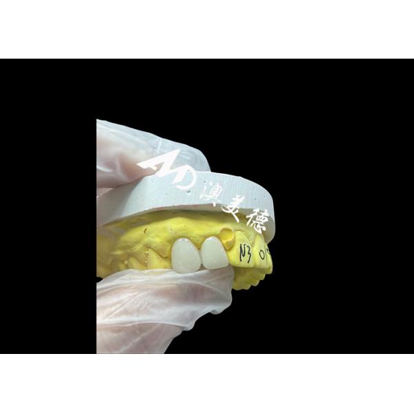 Quality Natural Zirconia Dental Crowns With High Strength And Biocompatibility for sale