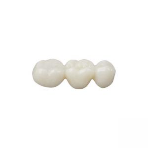 China Exercising Chewing Function Ceramic Dental Crown Restore Chewing Power OEM on sale