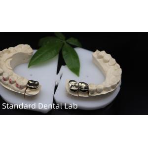 Buy cheap Professional ISO and FDA Approved Yellow Gold Crown for Dental Lab Shipping UPS Or Fedex Production Time 2 Days from wholesalers
