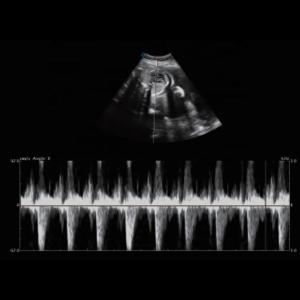 Buy cheap Fetal Doppler Medical Ultrasound Machine Trolley 3D 4D 5D from wholesalers