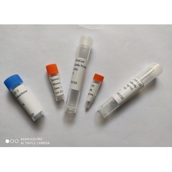 Quality Recombinant 2019-NCoV Mouse Monoclonal Antibody Spike RBD Protein for sale