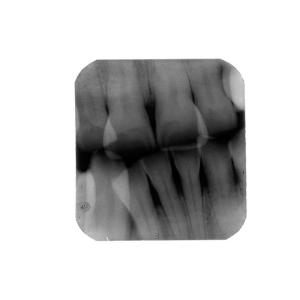 Buy cheap BLX-5 Panoramic Tripod Optional Portable Digitizer Dental X-ray Unit from wholesalers