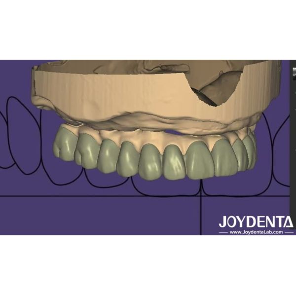 Buy cheap Individualized Design Digital Diagnostic Wax Up Lab Software Seamless Integration from wholesalers