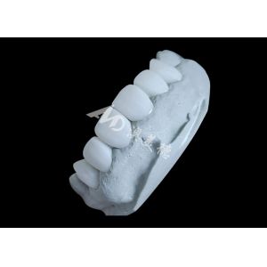 Buy cheap Zirconia Dental Crown Delivering Unbeatable Strength And Natural Smoothness,And Natural Translucency from wholesalers