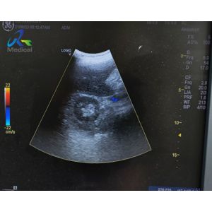 Buy cheap GE 4C-RS Convex Probe Ultrasound Transducer Lens Replacement from wholesalers