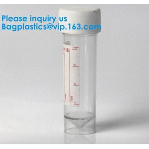 Sterile Disposable Hospital Sample 60ml 100 120 Ml Test Measurement Collection