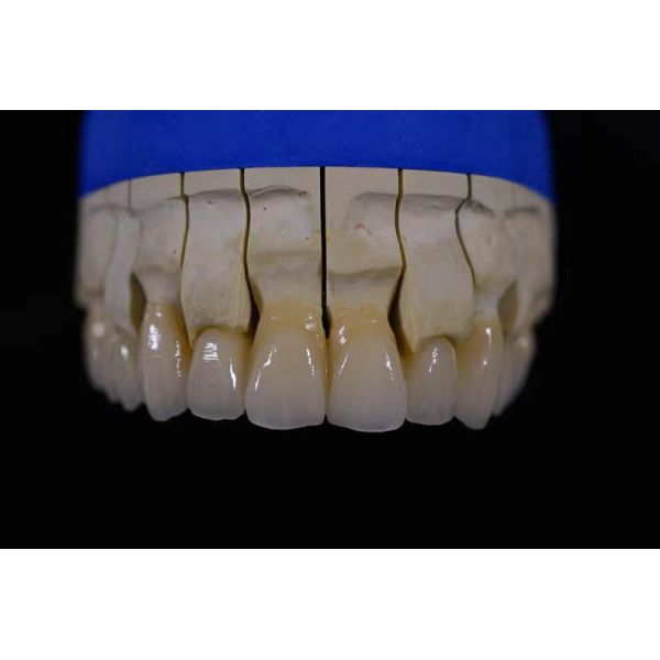 Quality Denture Fabrication Lab Achieving Perfectly White Dentures with Zirconia Repair for sale