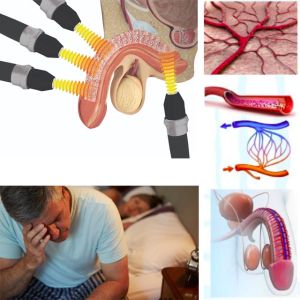 Buy cheap ESWT Rehabilitation Center Shockwave Therapy Machine 5000000 Shot from wholesalers