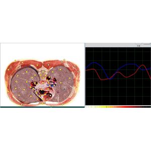 Meridian Test Metatron Nls 4025 Hunter Body Analyzer Health Diagnostic Machine