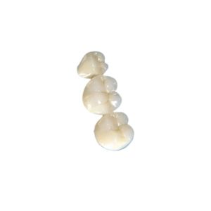 China Hard Texture Dental Crowns And Bridges Exercising Chewing Function Comfortable on sale