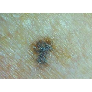 Manual Focus Wireless Digital Skin Analyzer Microscope for Hair and Skin with