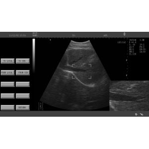 Mini Veterinary Ultrasound Scanner