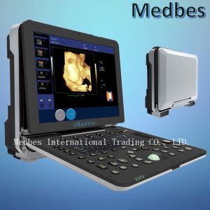 Buy cheap 4D Portable Color Ultrasound System Scanner Color Doppler Ultrasound Scanner is Based on Windows from wholesalers