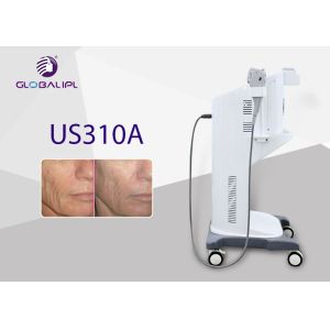 Vertical 3D Hifu Face Lifting Machine , High Intensity Focused Ultrasound