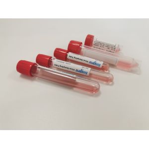 Buy cheap DNA Oral Sterile VTM Disposable Virus Sampling Kits from wholesalers