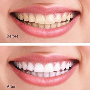 Buy cheap Natural Coconut Charcoal Teeth Whitening Powder To Remove Tooth Stains from wholesalers