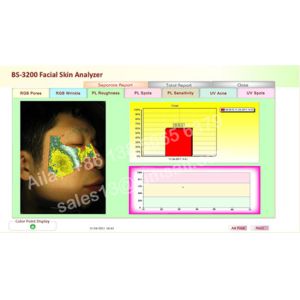 Buy cheap canon camera skin analyzer beauty equipment digital camera visia skin analysis machine from wholesalers