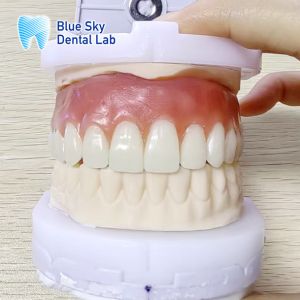 Buy cheap Custom Full Upper Acrylic Denture Natural Acrylic Removable Partial Denture from wholesalers