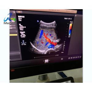 Buy cheap  EPIQ 7 Report Error 227 Ultrasound Machine Repair Replace ACB Board from wholesalers