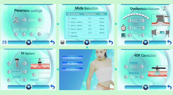 Quality Most advanced multifunctional cryolipolysis fast slimming machine,Chinese manufacturer for sale