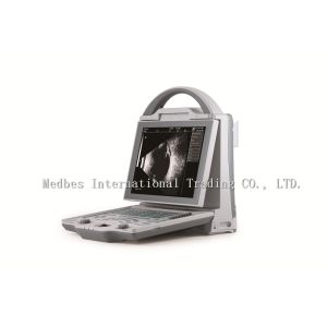 Buy cheap Full digital A/B scan portable cheapest Ophthalmic Ultrasound from wholesalers