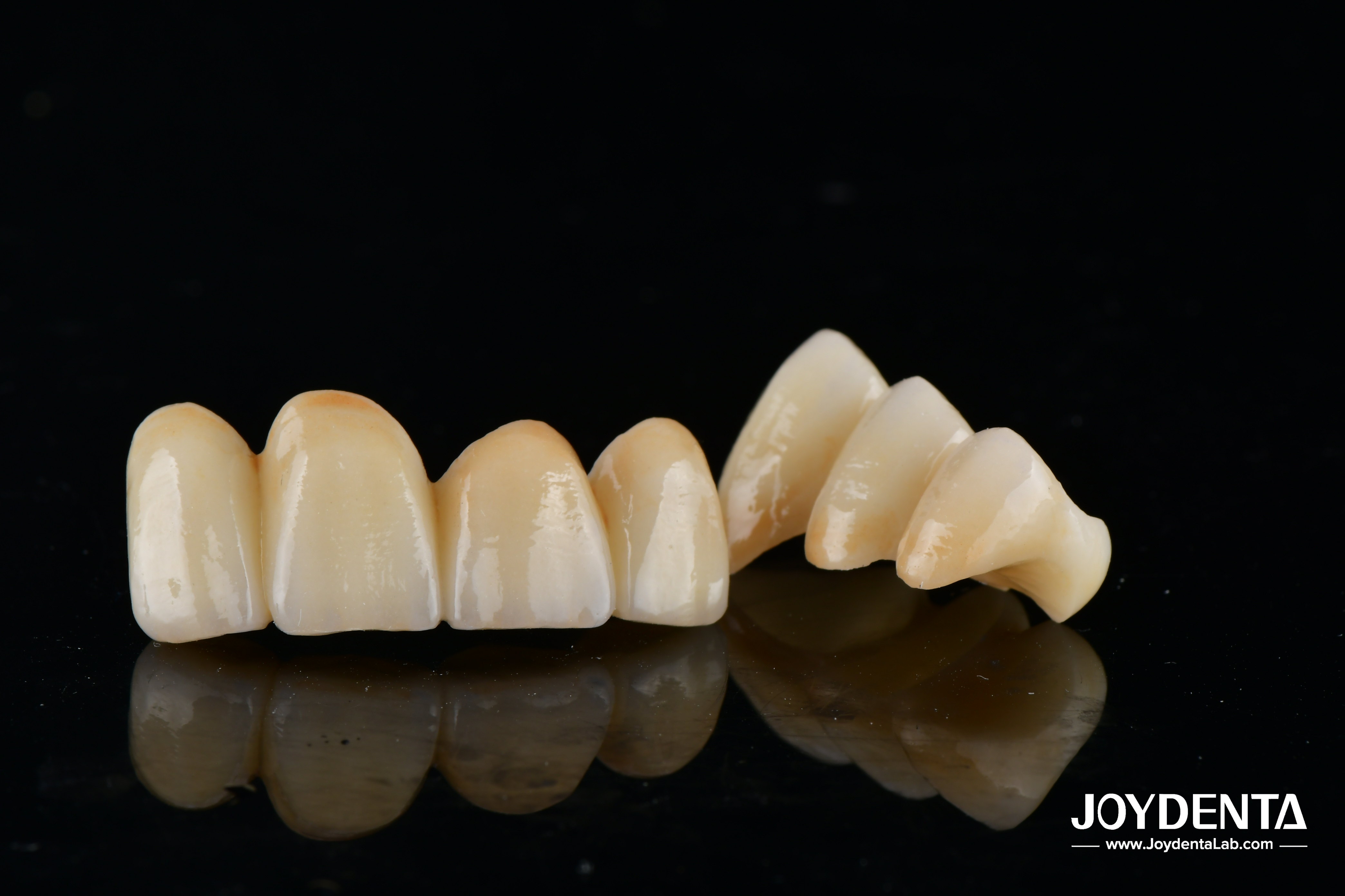 Unveil True Biomimicry: Introducing Our Multi-Layered Zirconia Aesthetic Bridge