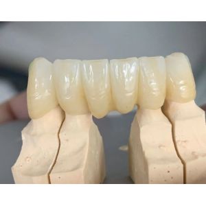 Yucera 3D Pro Multilayer Multilayer Zirconia Block Cad /cam System Ceramic Block