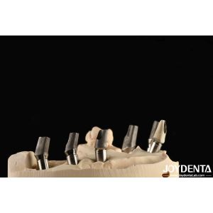 Buy cheap Custom Made Polished Titanium Abutment Cement Retetion V Shaped Thread Type product