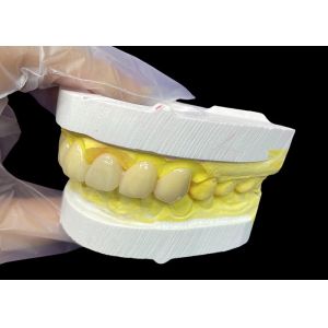 Buy cheap Cosmetic Vita Classical Shade Ceramic Crowns and Bridges with Precise Fit Natural Look and Customizable Options from wholesalers