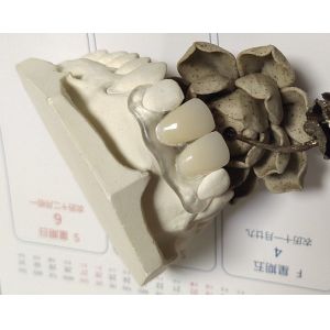 Buy cheap Soft Elastic Nylon Trushine Invisible Denture from wholesalers
