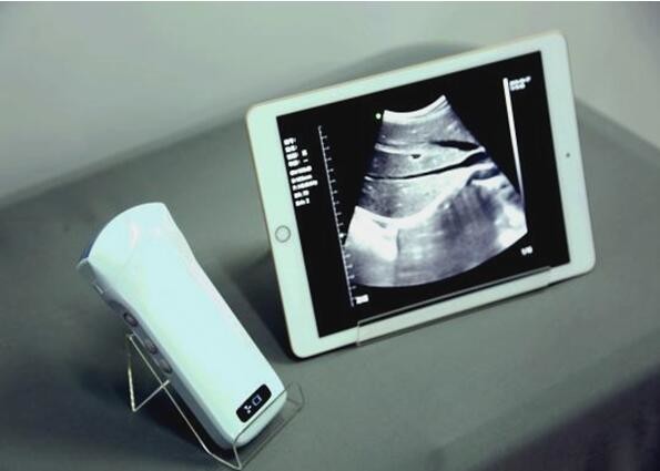 Buy cheap Windows Pocket Ultrasound Scanner Machines Electronic Phased Array from wholesalers