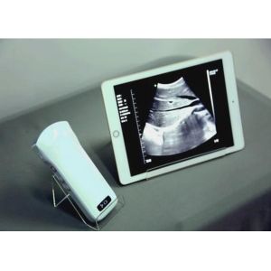 Buy cheap Windows Pocket Ultrasound Scanner Machines Electronic Phased Array from wholesalers