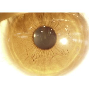 Handheld Slit Lamp 16G Digital Fundus Camera 80000 Images