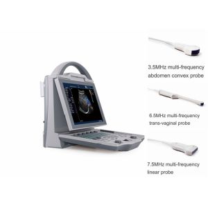Buy cheap Portable Pregnancy Ultrasound Scanner with Abdominal Convex Transvaginal Transducers from wholesalers