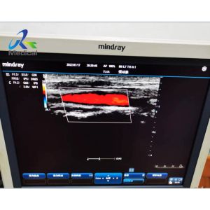 Buy cheap Abnormal Image Ultrasound Machine Repair Service Mindray DC-3 from wholesalers