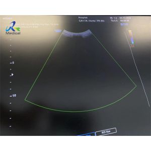 Ultrasound Probe Transducer Replce Strain Relief Cable And Lense Samsung CA1-7A