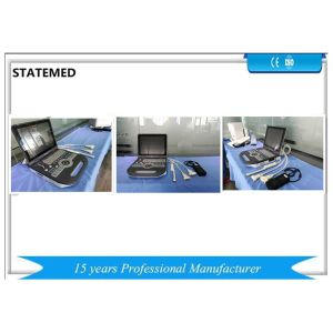 Buy cheap Human Color Doppler Ultrasound Scanner With 80 E / 128 E High Definition Image from wholesalers