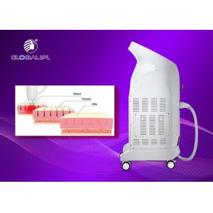 Buy cheap Permanent Painfree Diode Hair Removal Laser Machine 1 - 10Hz Frequency from wholesalers