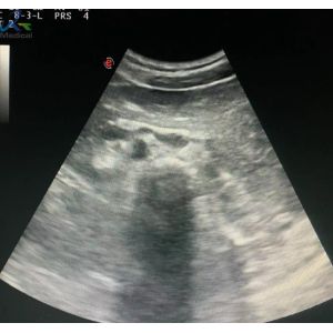 Buy cheap Biosound CA541 Convex Array Probe Vascular Urology Ultrasound Transducer Medical System from wholesalers