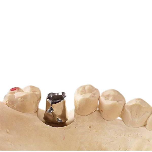 Quality Milling Process Pure Titanium Abutment Implants Durable Good Biocompatibility for sale