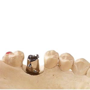 Buy cheap Milling Process Pure Titanium Abutment Implants Durable Good Biocompatibility from wholesalers