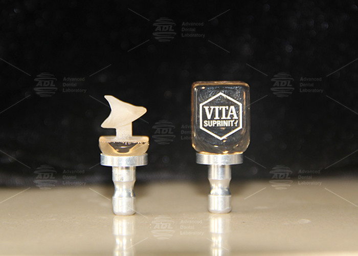 Quality Hybrid Ceramic Vita Enamic Single Tooth Restorations With High Translucency for sale Buy cheap Hybrid Ceramic Vita Enamic Single Tooth Restorations With High Translucency product