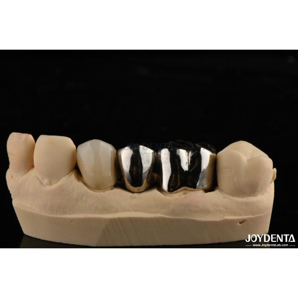 Quality Abrasion Resistant Metal Alloy Crown For Customized Dental Restorations for sale