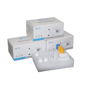 Buy cheap Infectious disease diagnostic Hepatitis B e Antgen(HBeAg) for Closed Automatic immunoassay analyzer in Infectious Diseas from wholesalers