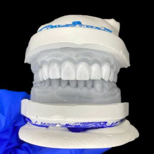 Buy cheap Diagnostic Wax-Up for Porcelain Veneers from wholesalers
