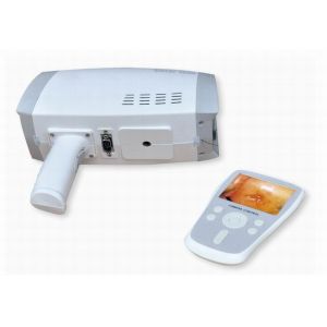 High-Resolution Imaging Digital electronic Colposcope Handheld Video Colposcope