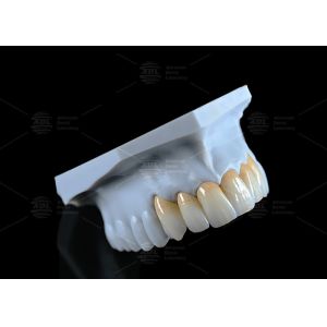 High Translucency Full Contour Zirconia Bridge Chipping Resistance Natural