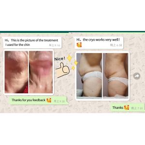 360 Cryolipolyse Cryotherapy Machine / Criolipolisis Machine Cryolipolysis